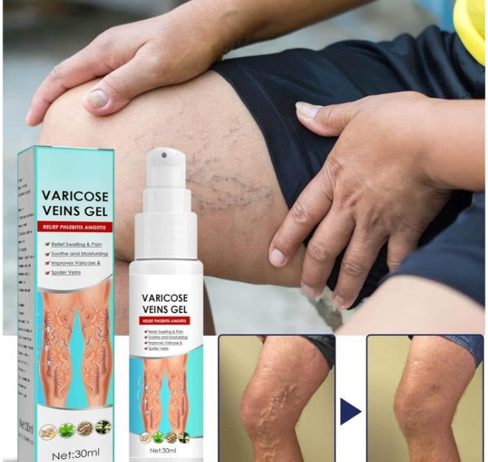 Varicose Veins Gel (Pack of 2)
